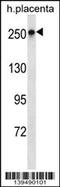 hScrib antibody, 60-158, ProSci, Western Blot image 