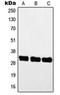 Myogenic factor 5 antibody, orb214287, Biorbyt, Western Blot image 