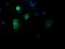 DEF6 Guanine Nucleotide Exchange Factor antibody, MA5-26116, Invitrogen Antibodies, Immunocytochemistry image 