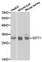Glutathione S-transferase theta-1 antibody, TA327030, Origene, Western Blot image 