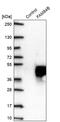 LRAT Domain Containing 2 antibody, PA5-62240, Invitrogen Antibodies, Western Blot image 