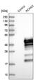 RCAN Family Member 3 antibody, NBP1-84972, Novus Biologicals, Western Blot image 