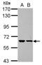 Zinc Finger Protein 567 antibody, NBP2-21028, Novus Biologicals, Western Blot image 