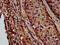 Lysosomal Protein Transmembrane 4 Beta antibody, CSB-PA774814LA01HU, Cusabio, Immunohistochemistry paraffin image 