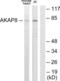 A-Kinase Anchoring Protein 8 antibody, LS-B8397, Lifespan Biosciences, Western Blot image 
