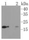 Ubiquitin Conjugating Enzyme E2 I antibody, NBP2-67564, Novus Biologicals, Western Blot image 