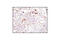 FAS antibody, 3180T, Cell Signaling Technology, Immunohistochemistry paraffin image 