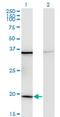 Ribosomal Protein L17 antibody, H00006139-M01, Novus Biologicals, Western Blot image 