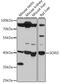 Sorbitol Dehydrogenase antibody, 16-202, ProSci, Western Blot image 