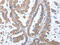 Growth factor receptor-bound protein 14 antibody, CSB-PA900627, Cusabio, Immunohistochemistry paraffin image 