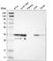 Capping Actin Protein Of Muscle Z-Line Subunit Alpha 2 antibody, HPA007643, Atlas Antibodies, Western Blot image 