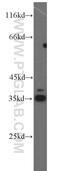 Dehydrogenase/Reductase 1 antibody, 16275-1-AP, Proteintech Group, Western Blot image 