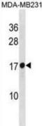 Ribosomal Protein L30 antibody, abx031255, Abbexa, Western Blot image 