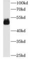 Estrogen Receptor 2 antibody, FNab02867, FineTest, Western Blot image 