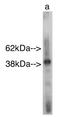 Sterile Alpha Motif Domain Containing 8 antibody, AP05209PU-N, Origene, Western Blot image 