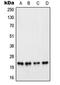Poly(ADP-Ribose) Polymerase 1 antibody, LS-C351819, Lifespan Biosciences, Western Blot image 