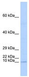 TAL BHLH Transcription Factor 2 antibody, TA343537, Origene, Western Blot image 