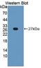 Phospholipase C Like 1 (Inactive) antibody, LS-C663436, Lifespan Biosciences, Western Blot image 