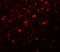 Coiled-Coil Domain Containing 88A antibody, LS-B5063, Lifespan Biosciences, Immunofluorescence image 