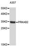 Protein Kinase AMP-Activated Non-Catalytic Subunit Beta 2 antibody, STJ25117, St John
