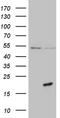 PRELI Domain Containing 2 antibody, TA810771, Origene, Western Blot image 