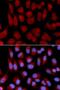 Transporter 2, ATP Binding Cassette Subfamily B Member antibody, LS-B14864, Lifespan Biosciences, Immunofluorescence image 