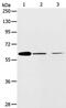 ATP Binding Cassette Subfamily E Member 1 antibody, PA5-50287, Invitrogen Antibodies, Western Blot image 