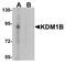 Lysine-specific histone demethylase 1B antibody, A08071, Boster Biological Technology, Western Blot image 