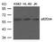 Docking protein 1 antibody, 79-393, ProSci, Western Blot image 