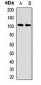 Zinc Finger CCCH-Type Containing 14 antibody, orb411741, Biorbyt, Western Blot image 