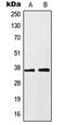 Homeobox protein Hox-A1 antibody, LS-B13574, Lifespan Biosciences, Western Blot image 