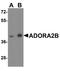 Adenosine A2b Receptor antibody, A05238, Boster Biological Technology, Western Blot image 