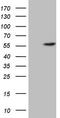 4-Aminobutyrate Aminotransferase antibody, TA806967, Origene, Western Blot image 