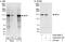 BCR Activator Of RhoGEF And GTPase antibody, A302-057A, Bethyl Labs, Immunoprecipitation image 