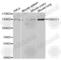 F-box only protein 11 antibody, A6153, ABclonal Technology, Western Blot image 
