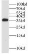 Protein Phosphatase 2 Catalytic Subunit Beta antibody, FNab06713, FineTest, Western Blot image 