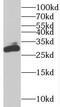 Bridging Integrator 3 antibody, FNab00900, FineTest, Western Blot image 