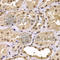Cysteine-rich protein 2-binding protein antibody, A7380, ABclonal Technology, Immunohistochemistry paraffin image 