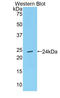 TIMP Metallopeptidase Inhibitor 4 antibody, LS-C298950, Lifespan Biosciences, Western Blot image 