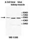 Zinc Finger MYND-Type Containing 10 antibody, orb77942, Biorbyt, Western Blot image 