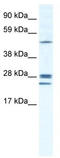 Gap Junction Protein Beta 2 antibody, TA341663, Origene, Western Blot image 
