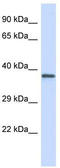Platelet glycoprotein Ib alpha chain antibody, TA339190, Origene, Western Blot image 