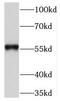 NIMA Related Kinase 3 antibody, FNab05653, FineTest, Western Blot image 