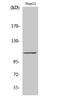 General Transcription Factor IIIC Subunit 2 antibody, A11837, Boster Biological Technology, Western Blot image 
