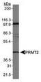 Protein arginine N-methyltransferase 2 antibody, TA309820, Origene, Western Blot image 