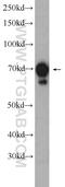Chaperone protein DnaK antibody, 25405-1-AP, Proteintech Group, Western Blot image 