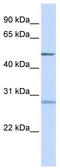 Zinc Finger Protein 141 antibody, TA339080, Origene, Western Blot image 