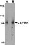 Centrosomal Protein 164 antibody, orb75166, Biorbyt, Western Blot image 