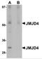 Jumonji Domain Containing 4 antibody, 5379, ProSci, Western Blot image 