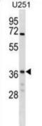 NSF Attachment Protein Gamma antibody, abx028620, Abbexa, Western Blot image 